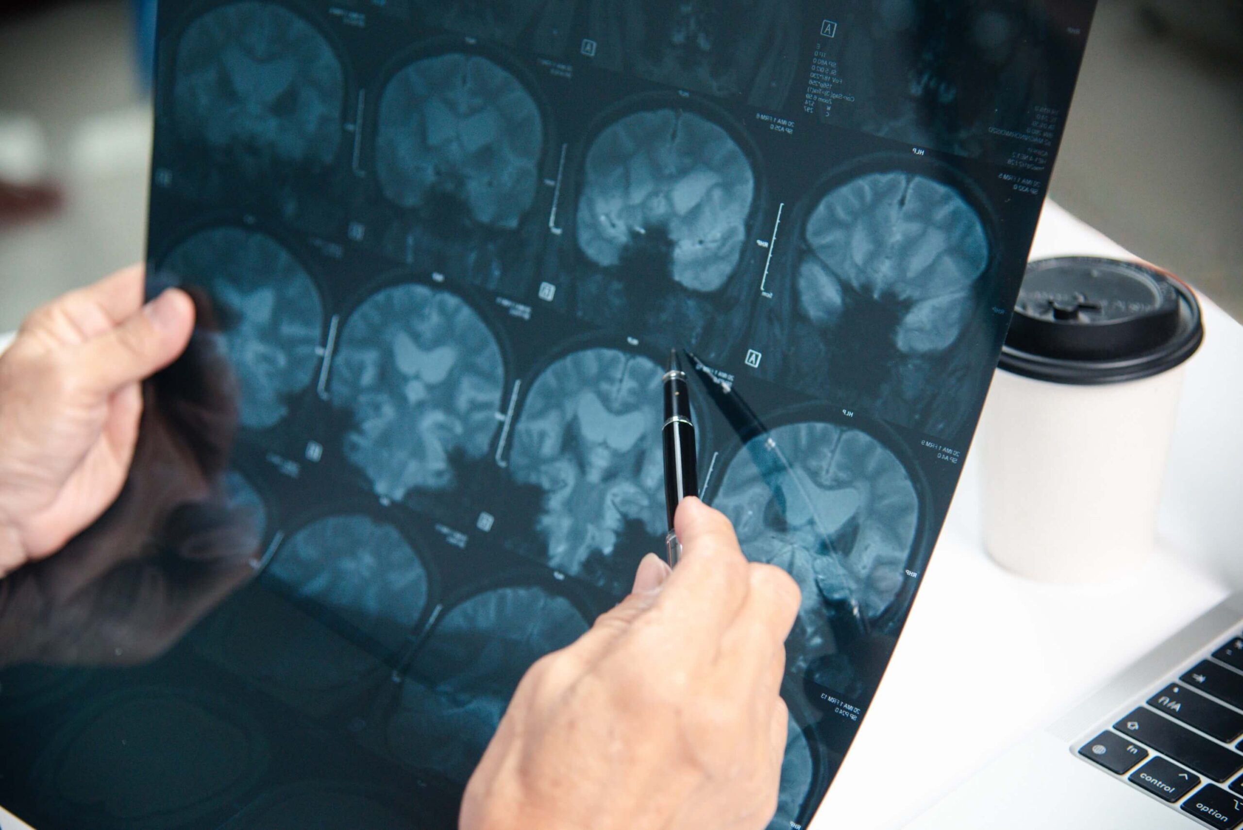 Doctor inspecting x-ray results